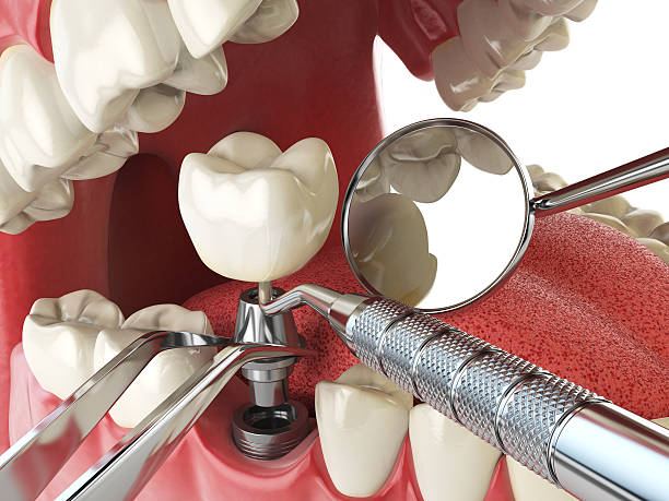 Best Weekend Emergency Dentist in Chisholm, ME